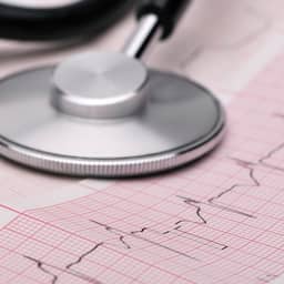 'Duurtraining heeft invloed op hartritme'