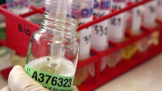 KNWU vindt alsnog geld voor honderd extra dopingcontroles