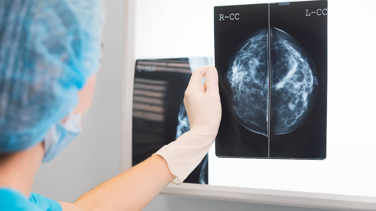Un trattamento speciale per il cancro al seno previene la chemioterapia o farmaci non necessari |  Salute