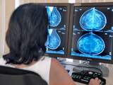 Borstkankeronderzoek om de 3 in plaats van 2 jaar door personeelstekort