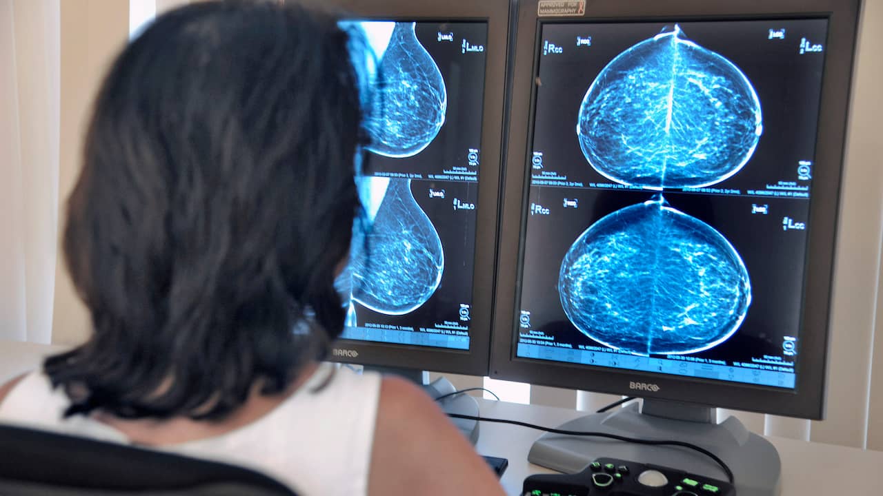 Breast cancer screening every 3 instead of 2 years due to staff shortage |  NOW