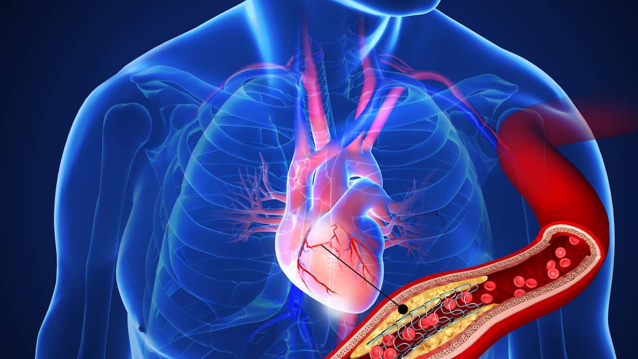 Which Test Required For Heart Disease