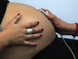 'Zwangerschap maakt kans op terugkeer borstkanker niet groter'