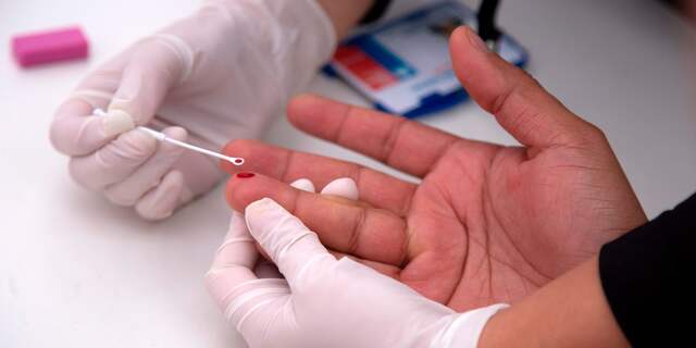 hiv-test