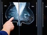 Nieuwe behandeling borstkanker voorwaardelijk in basispakket zorgverzekering