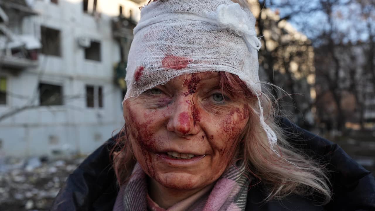 De gewonde Olena Kurilo in Kharkiv.