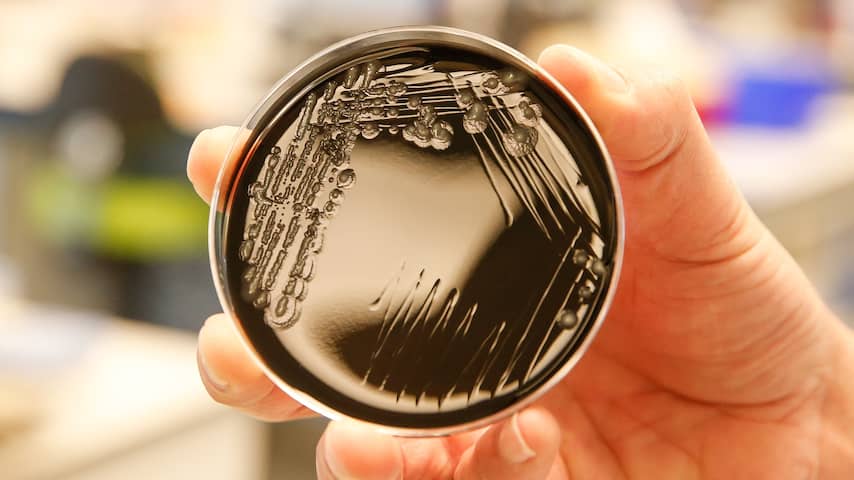 Legionella-uitbraak door cv-ketels: dit moet je erover weten
