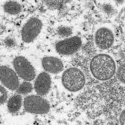 Vijf vragen over het apenpokkenvirus dat steeds vaker in Europa opduikt