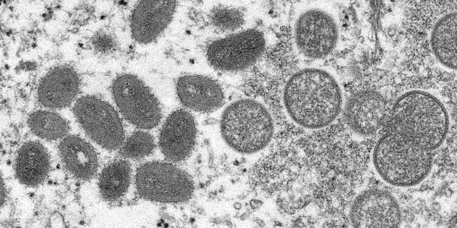 Apenpokkenvirus