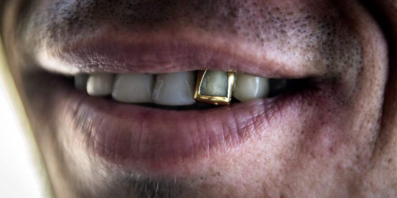 Duitse grafdelver beschuldigd van stelen gouden tanden van overledenen
