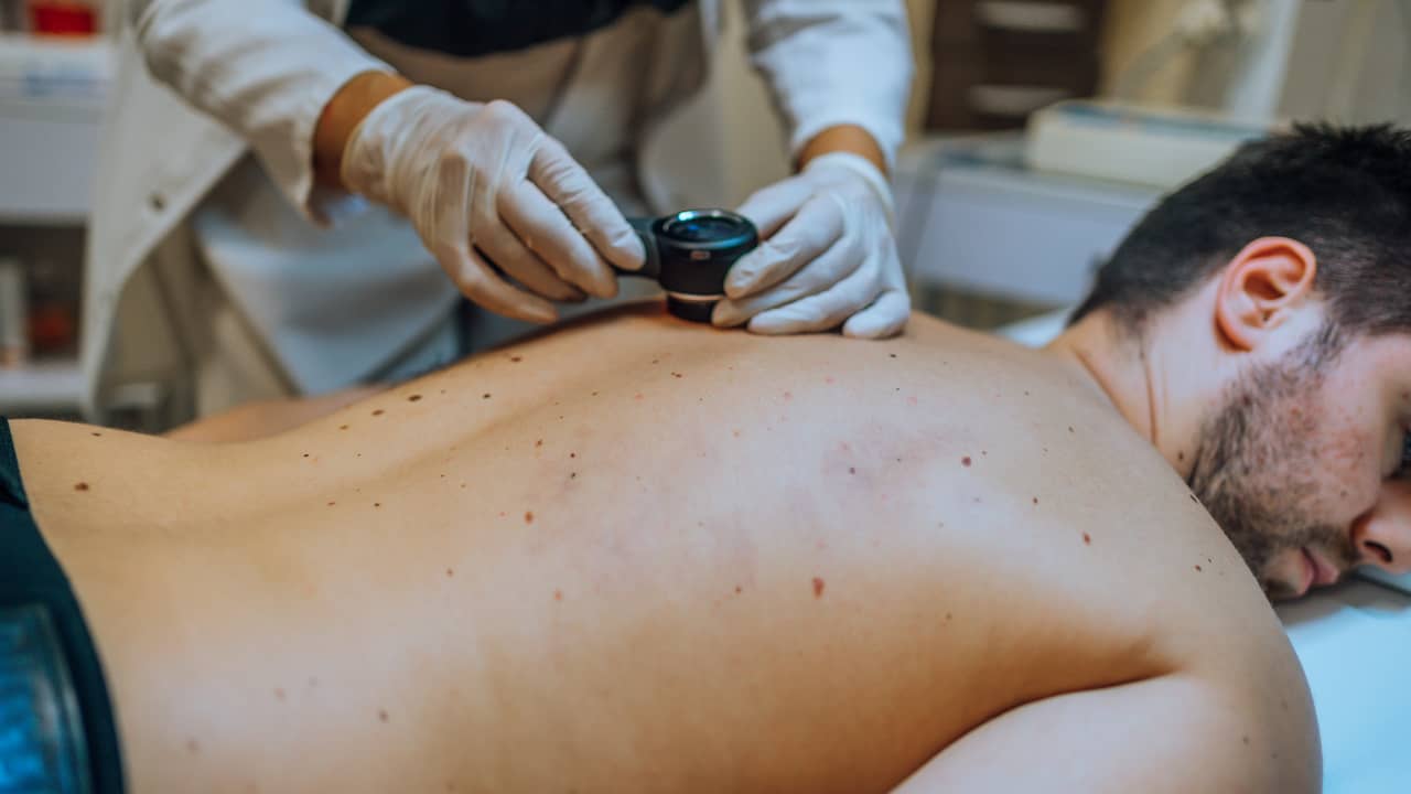 Le traitement avec vos propres cellules immunitaires réussit dans le cancer de la peau agressif |  Santé