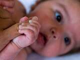 Onderzoek naar later doorsnijden navelstreng bij te kleine baby