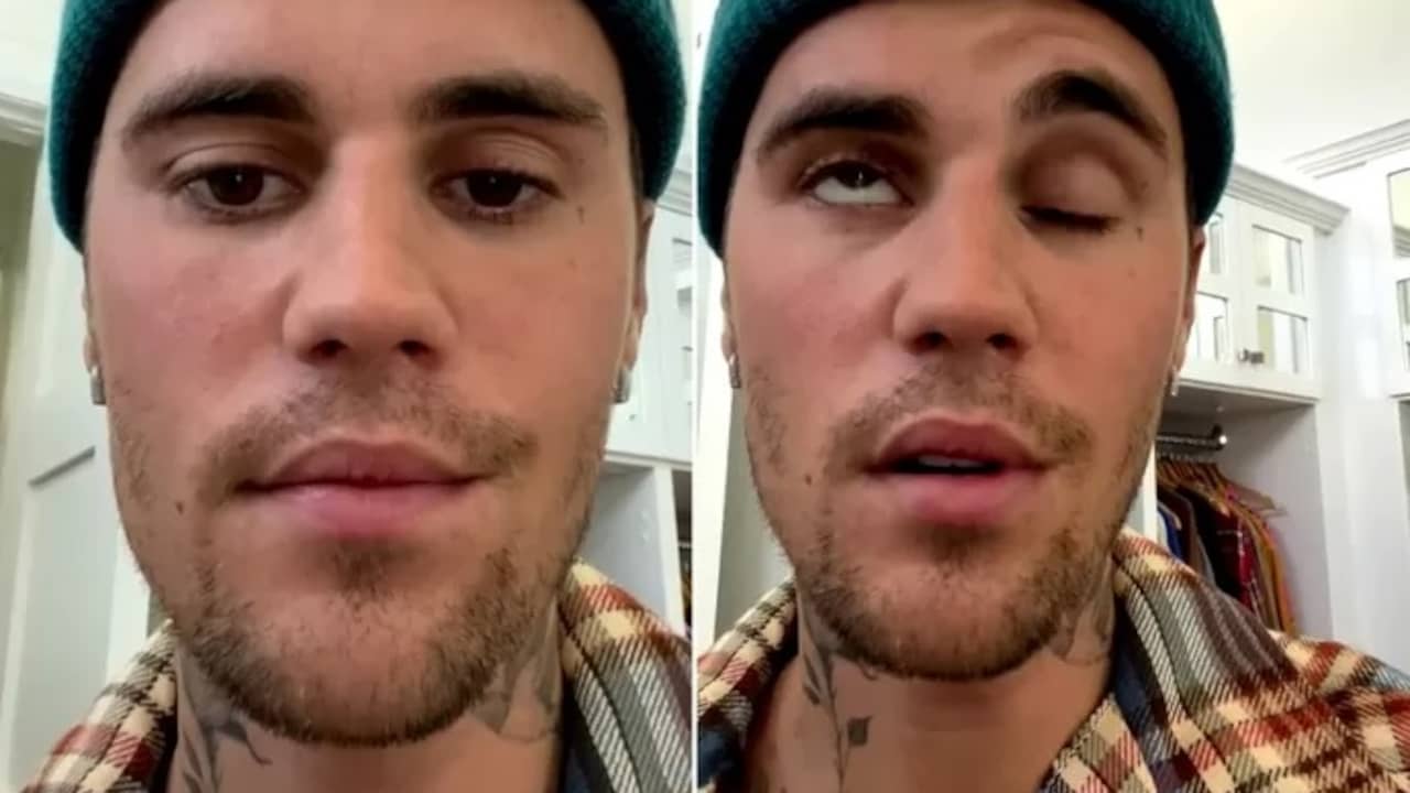 Beeld uit video: Justin Bieber vertelt op Instagram over zijn gezichtsverlamming