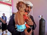 Een man brengt zijn kind naar het ziekenhuis in hoofdstad Sanaa.