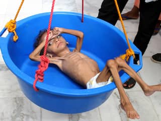 'Vijf miljoen kinderen in Jemen met hongerdood bedreigd'