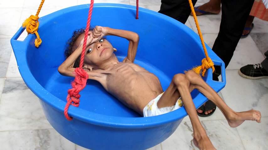 Verenigde Naties: Jemen aan rand van ongekende hongersnood