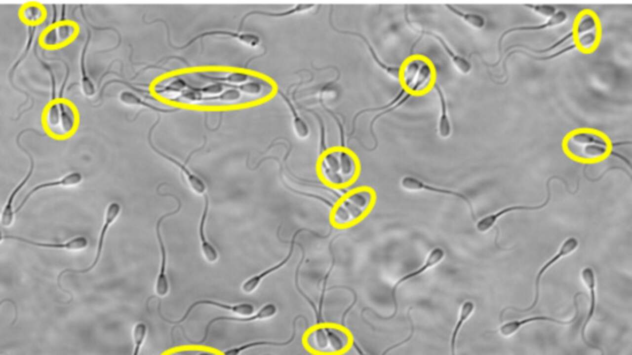 Les spermatozoïdes du «peloton» ont plus de chances de succès que les nageurs solitaires |  La science