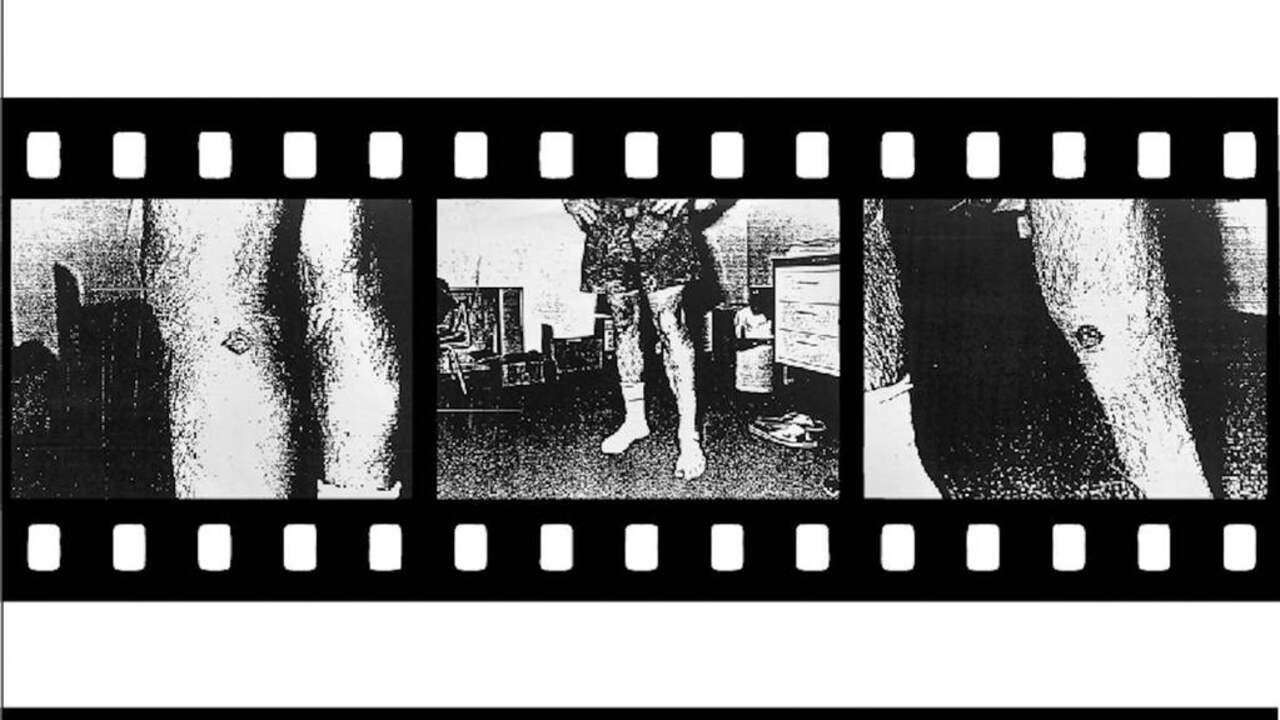 Foto's van de recherche tonen de brandwonden van Jan, die de schotwonden van 1977 moesten verhullen.