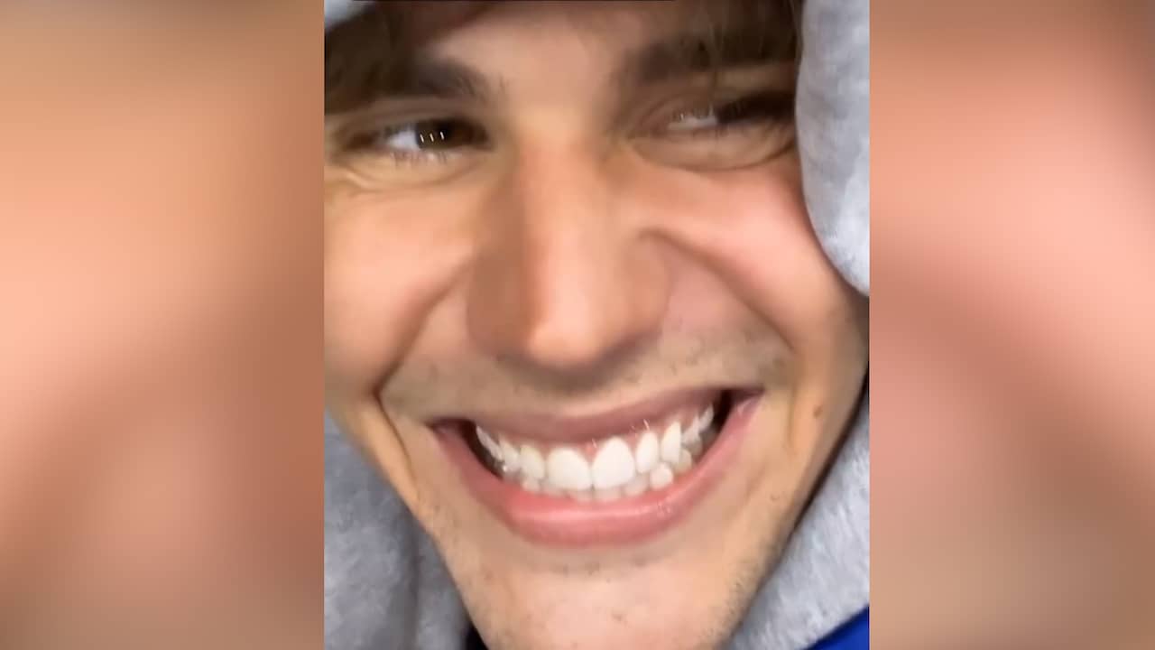 Beeld uit video: Justin Bieber kan weer lachen na gezichtsverlamming