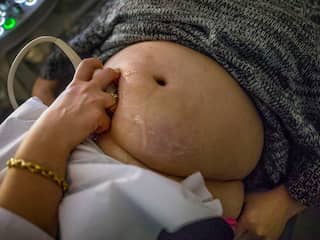 Moeder- en babysterfte in de wereld neemt maar niet af volgens WHO