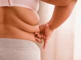 Moeten mensen met overgewicht eerder gescreend worden op diabetes?