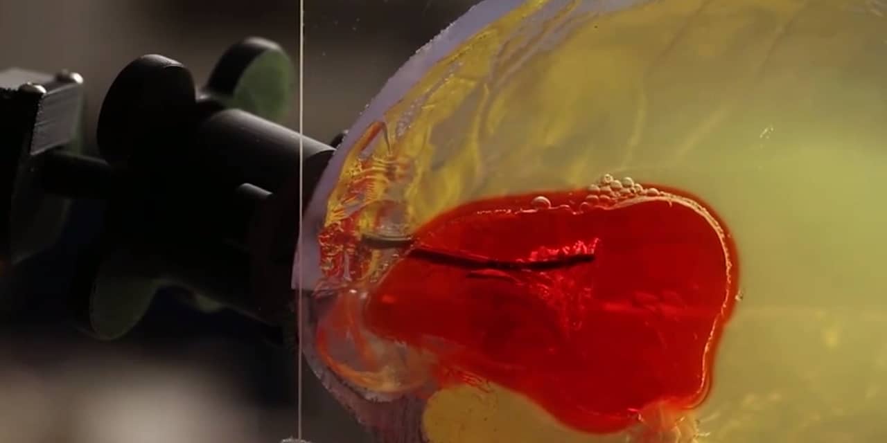 Robotgestuurde naald zuigt bloedproppen hersenen op