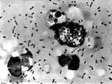 De pestbacterie onder een microscoop