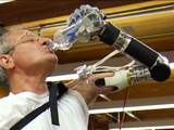 Segway-uitvinder mag bionische arm produceren