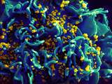 Negentien miljoen hiv-patiënten onbekend met virus