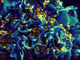 Toch weer hiv bij 'genezen' Amerikaanse baby