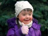Meer duidelijk over moleculaire achtergrond Downsyndroom