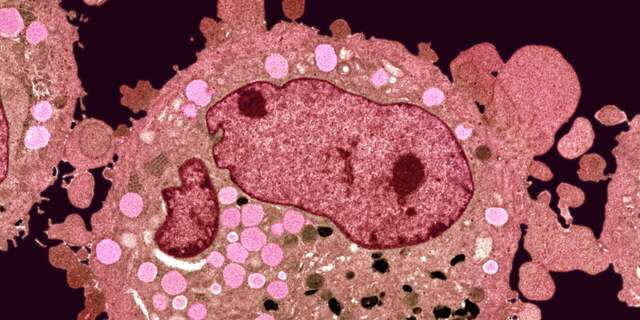 Kanker, tumor, kankercellen