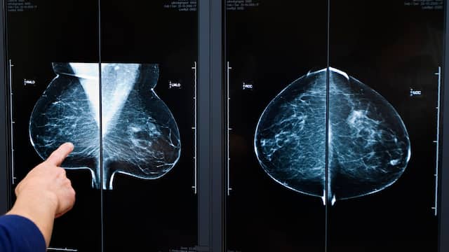 Ziekenhuis Twente heeft primeur met methode voor traceren borsttumor