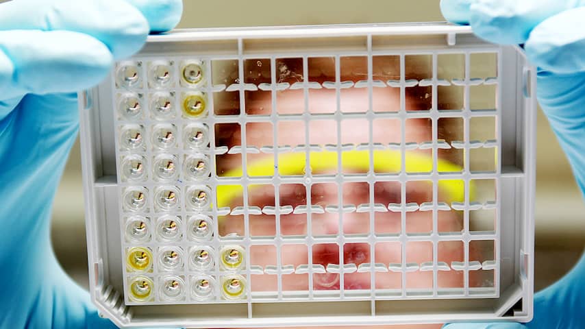 ehec laboratorium wetenschap wetenschapper