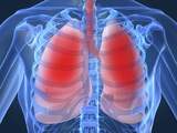 COPD-patiënt heeft meestal ook andere ziekte