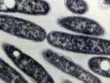 Achtergrond: Legionella gedijt goed in waterleidingen