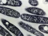 'Legionella bij honderden vakantieverblijven'