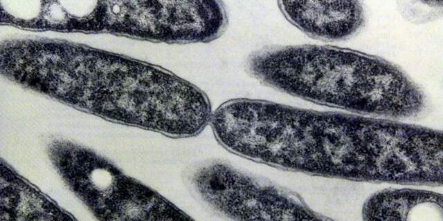 Legionella