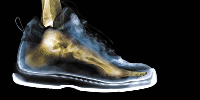 Schoenen