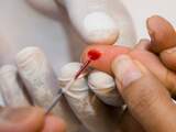 Doorbraak in stamcelonderzoek diabetes