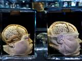 'Menselijk brein bevat unieke scheve plooi' 