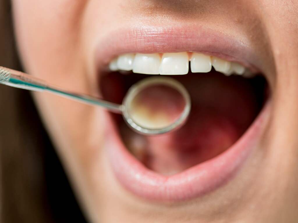 kennisgeving koppeling Verwaand Zorgt bepaalde tandpasta echt voor wittere tanden? | NU - Het laatste  nieuws het eerst op NU.nl