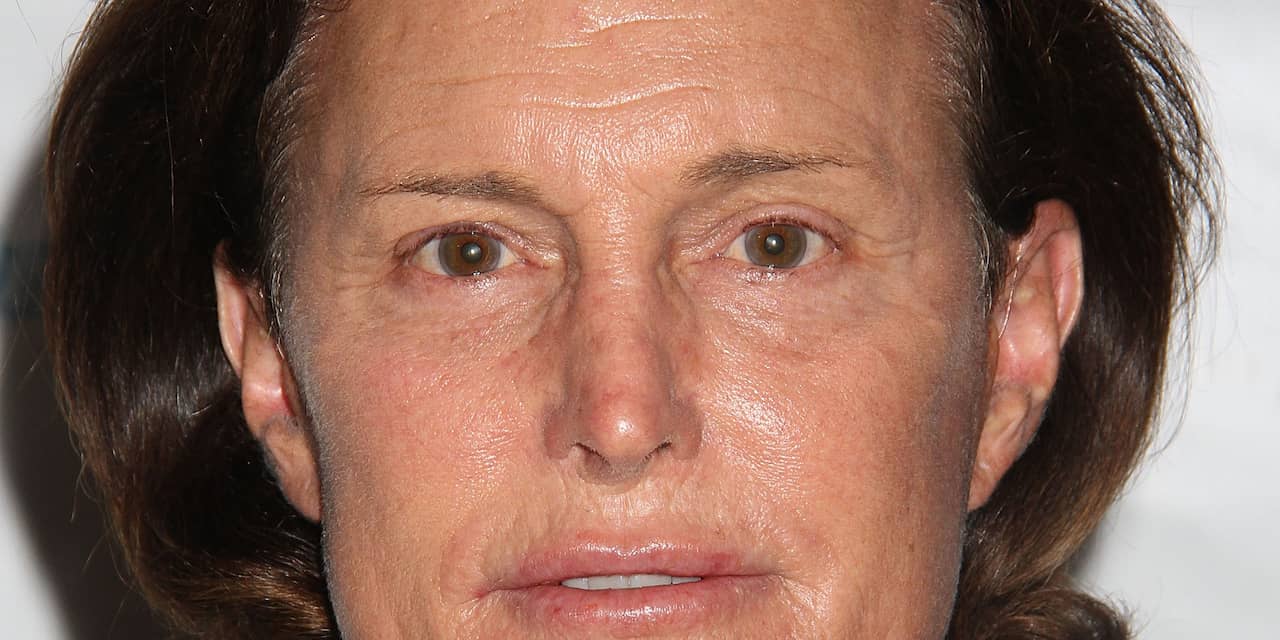 Bruce Jenner belt in auto drie dagen na fataal ongeluk