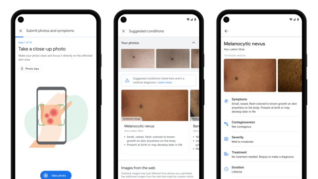 Screenshots van hoe de app eruit komt te zien.