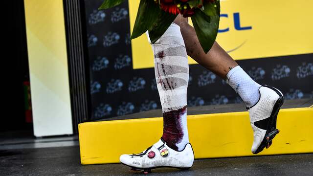   Gilbert's leg after the stage 