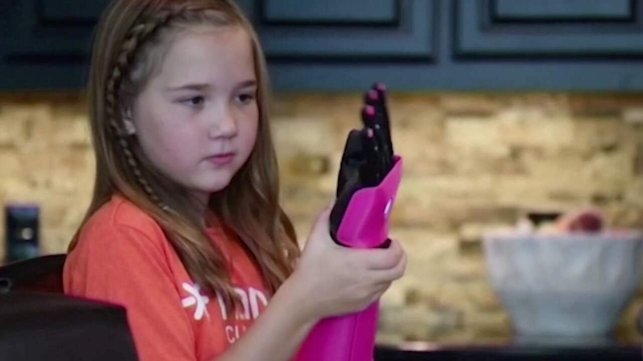 Mady (8) kan zelfstandig fietsen dankzij bionische hand
