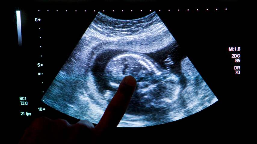 Gezondheidsraad wil extra echo voor zwangere vrouwen