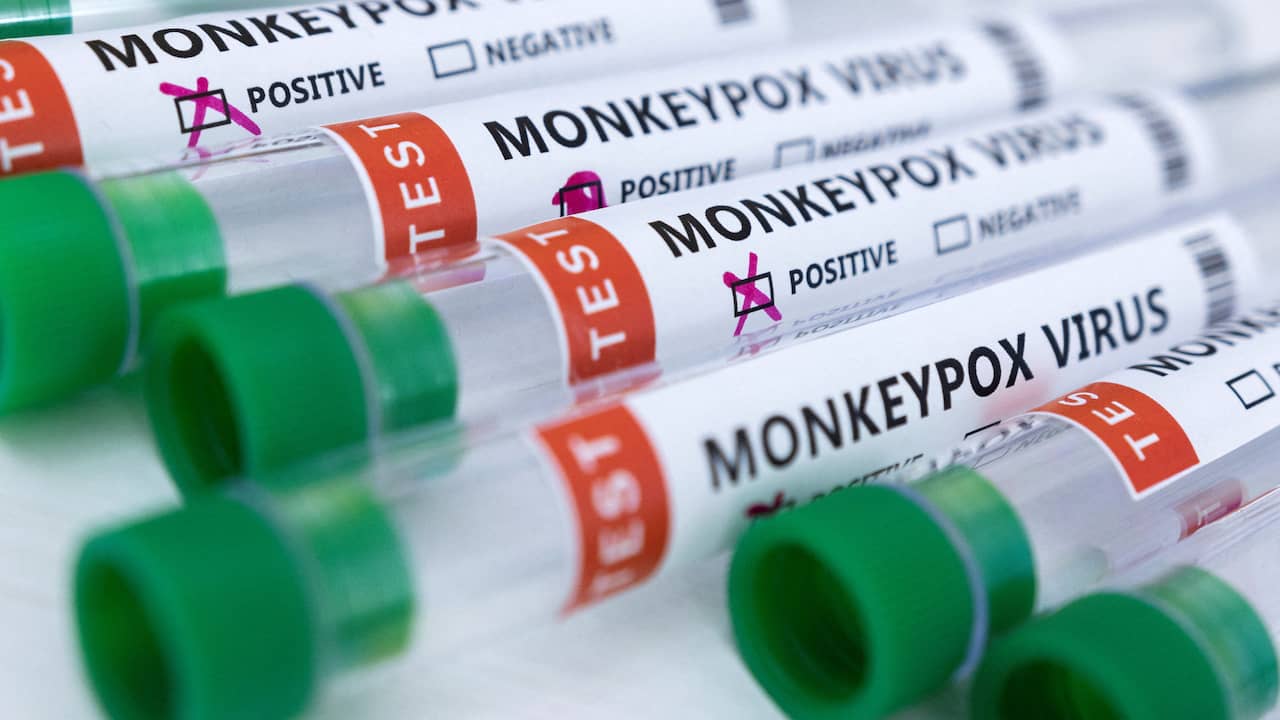 Monkeypox non diventerà una pandemia, secondo l’OMS, anche se finora si sa relativamente poco |  Attualmente