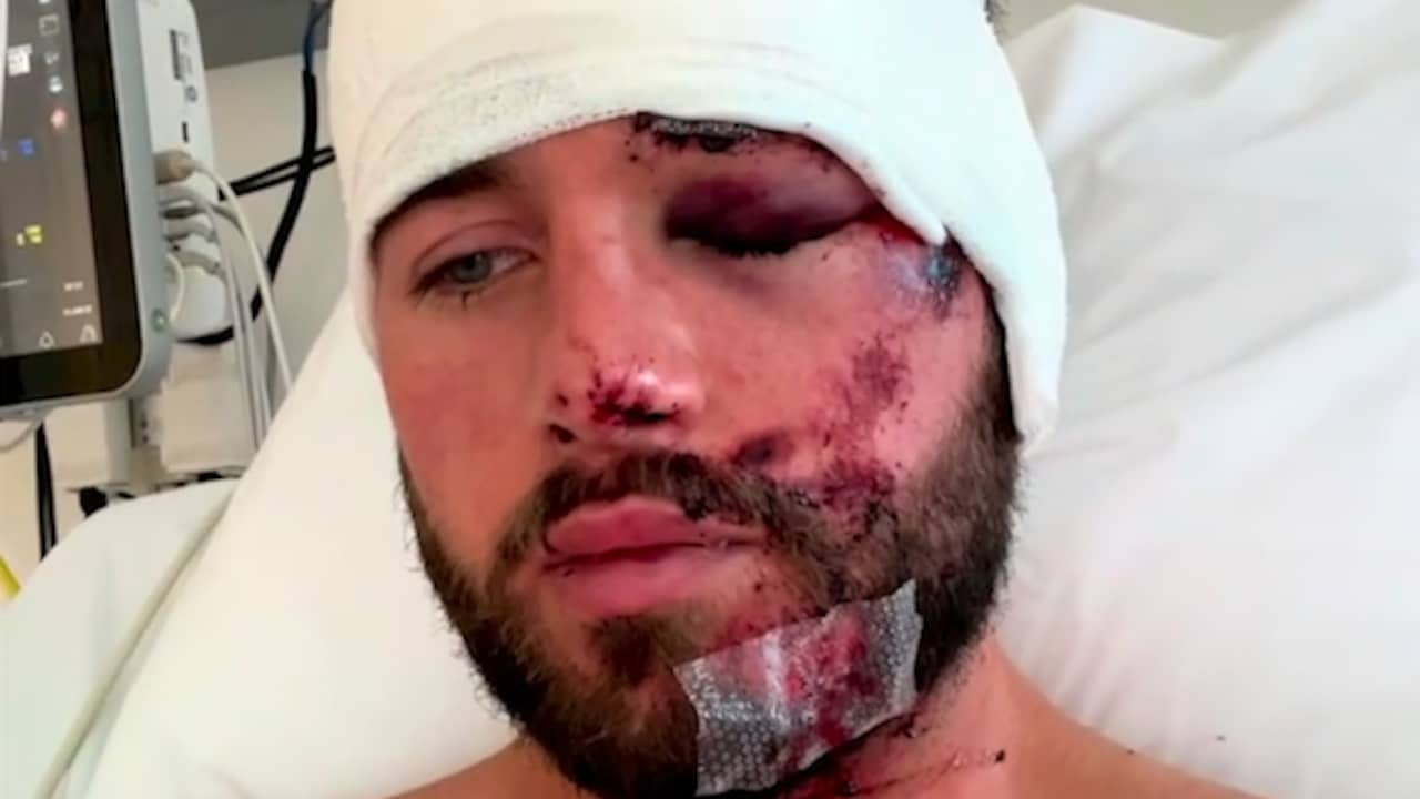 Beeld uit video: Donny Roelvink vertelt vanuit ziekenhuisbed over ongeluk