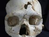 Archeologen vinden oudste bewijs voor menselijk geweld